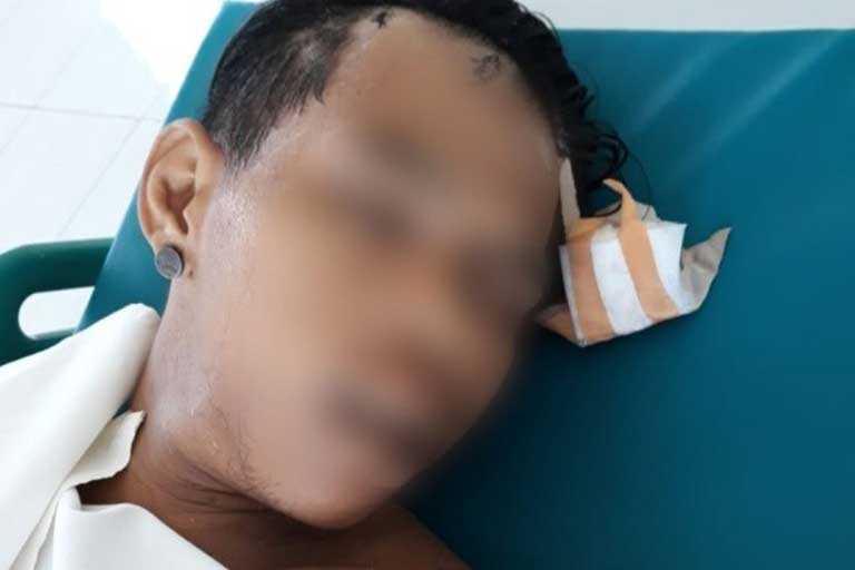 korban penganiayaan Jalan TMP